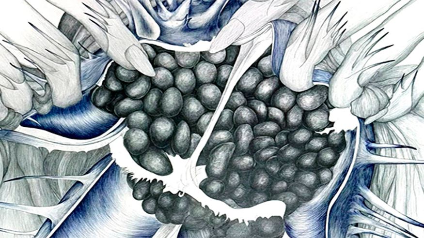 "Sasi guztien gainetik", exposición de Marlene McCarty Imagen de portada